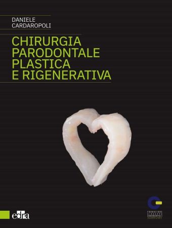 Chirurgia parodontale plastica e rigenerativa